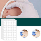 SkinClear - Patch for the removal of spots and warts Kalsten 0